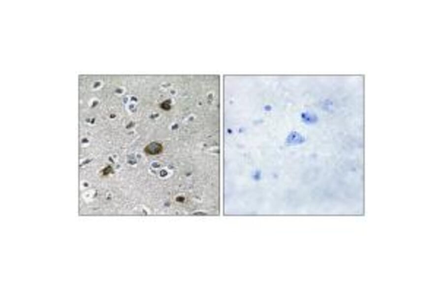 Immunohistochemistry - AKAP1 Antibody from Signalway Antibody (34003) - Antibodies.com