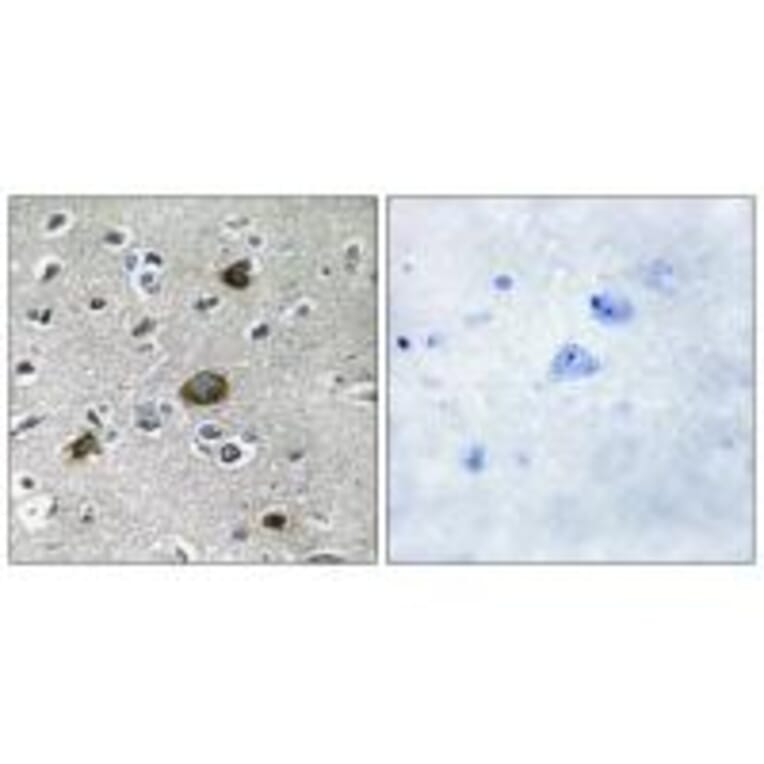 Immunohistochemistry - AKAP1 Antibody from Signalway Antibody (34003) - Antibodies.com