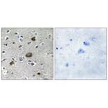 Immunohistochemistry - AKAP1 Antibody from Signalway Antibody (34003) - Antibodies.com