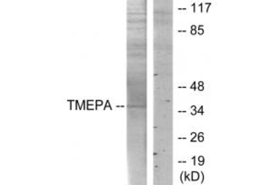 Western blot - TMEPA Antibody from Signalway Antibody (34019) - Antibodies.com