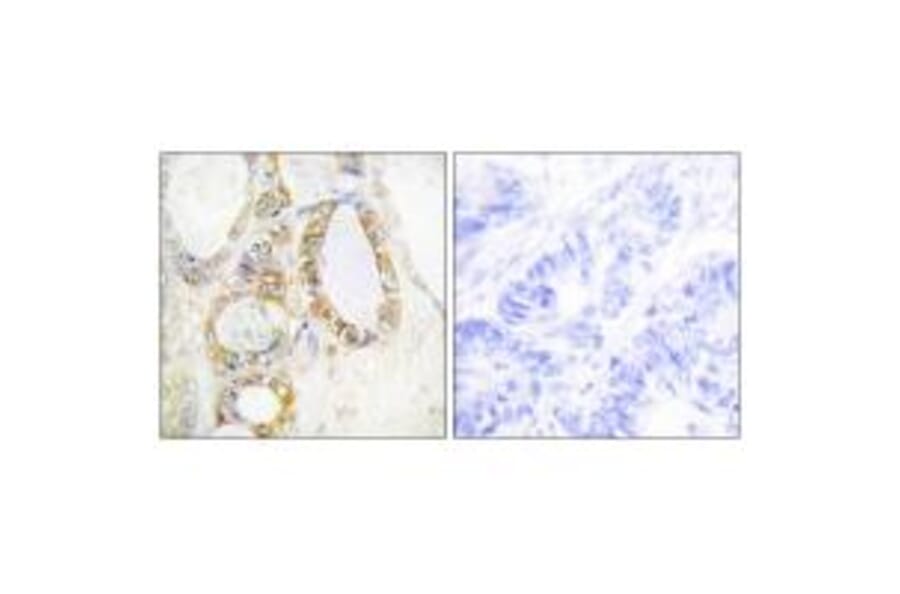Immunohistochemistry - MUC13 Antibody from Signalway Antibody (34062) - Antibodies.com