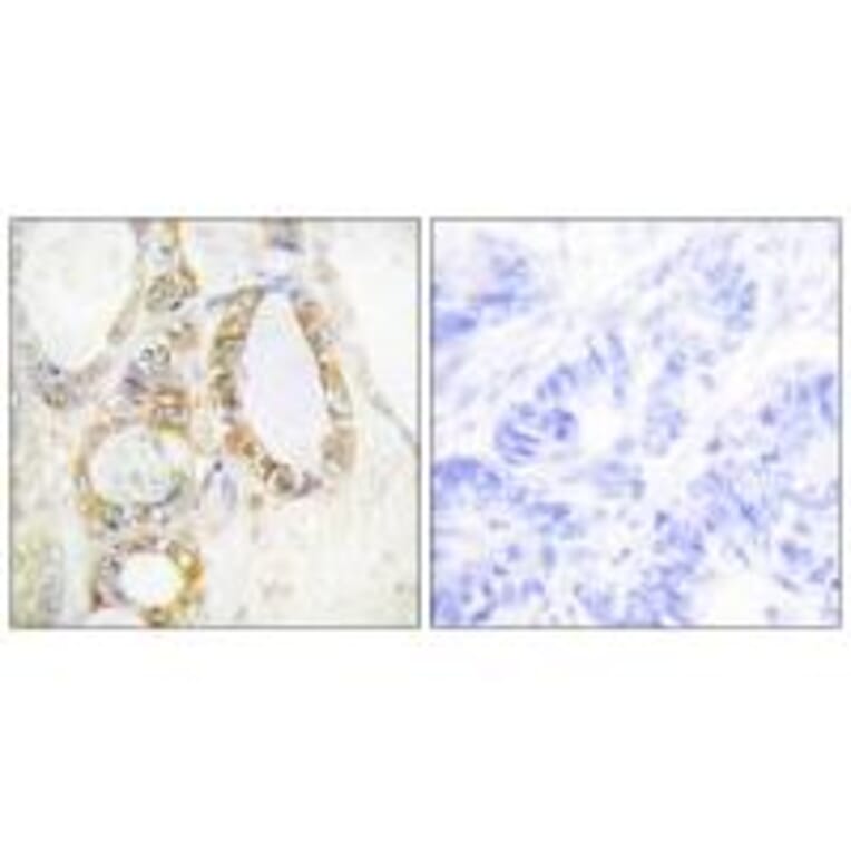 Immunohistochemistry - MUC13 Antibody from Signalway Antibody (34062) - Antibodies.com