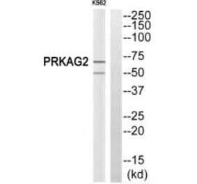 Western blot - PRKAG2 Antibody from Signalway Antibody (34097) - Antibodies.com