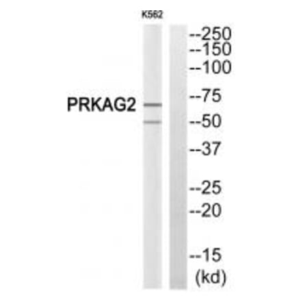 Western blot - PRKAG2 Antibody from Signalway Antibody (34097) - Antibodies.com