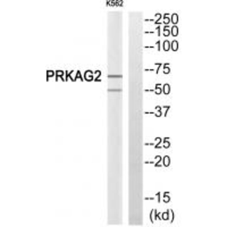 Western blot - PRKAG2 Antibody from Signalway Antibody (34097) - Antibodies.com