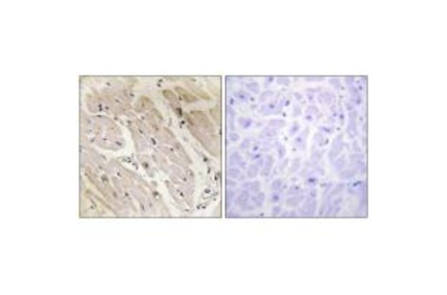Immunohistochemistry - PRKAG2 Antibody from Signalway Antibody (34097) - Antibodies.com