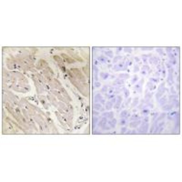 Immunohistochemistry - PRKAG2 Antibody from Signalway Antibody (34097) - Antibodies.com