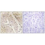 Immunohistochemistry - PRKAG2 Antibody from Signalway Antibody (34097) - Antibodies.com