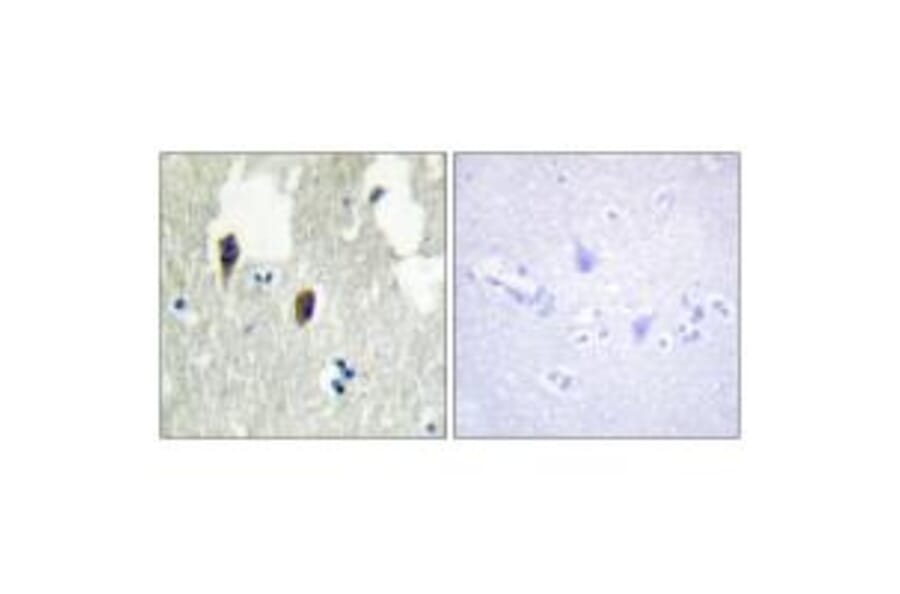 Immunohistochemistry - KLHL3 Antibody from Signalway Antibody (34101) - Antibodies.com
