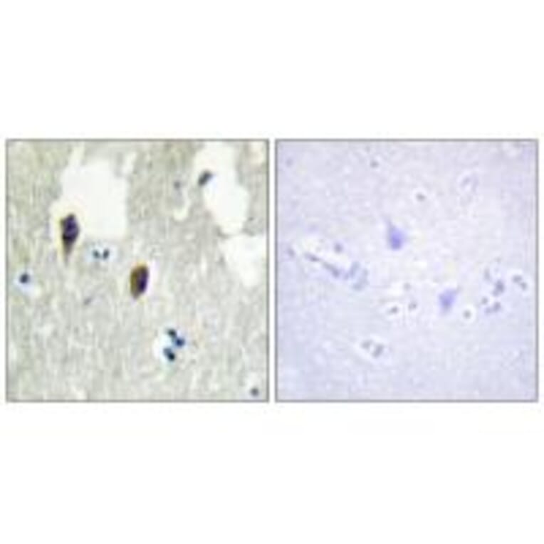 Immunohistochemistry - KLHL3 Antibody from Signalway Antibody (34101) - Antibodies.com
