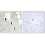 Immunohistochemistry - KLHL3 Antibody from Signalway Antibody (34101) - Antibodies.com