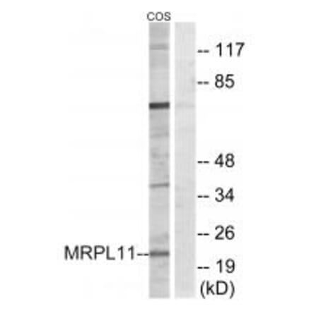 Western blot - MRPL11 Antibody from Signalway Antibody (34315) - Antibodies.com