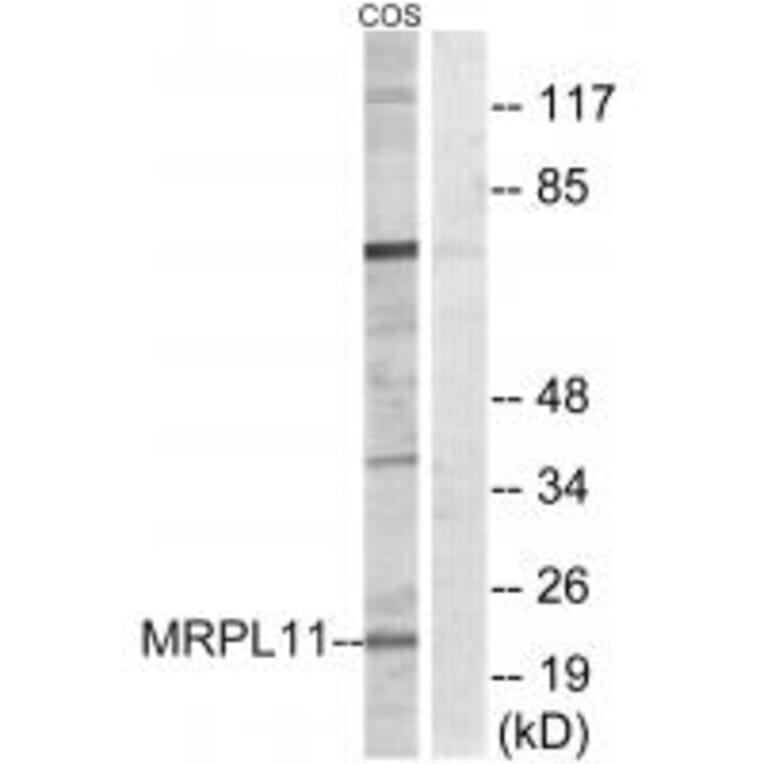 Western blot - MRPL11 Antibody from Signalway Antibody (34315) - Antibodies.com