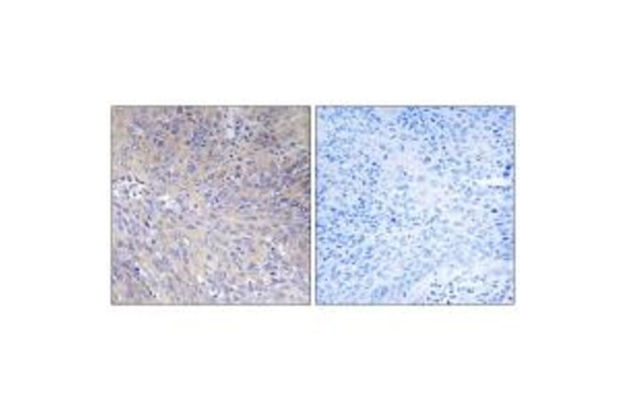Immunohistochemistry - MRPL11 Antibody from Signalway Antibody (34315) - Antibodies.com