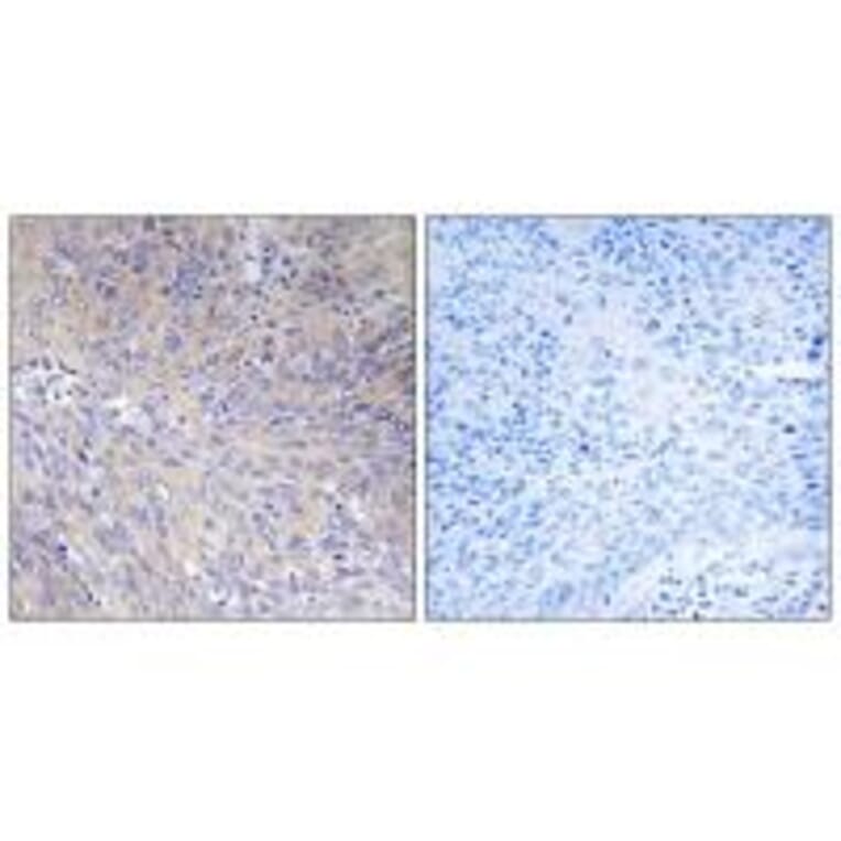 Immunohistochemistry - MRPL11 Antibody from Signalway Antibody (34315) - Antibodies.com