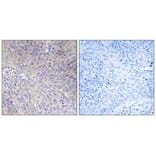 Immunohistochemistry - MRPL11 Antibody from Signalway Antibody (34315) - Antibodies.com
