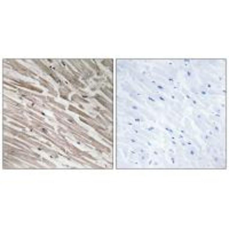 Immunohistochemistry - MRPL44 Antibody from Signalway Antibody (34325) - Antibodies.com