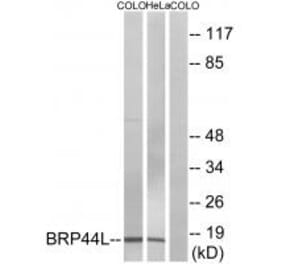 Western blot - BRP44L Antibody from Signalway Antibody (34505) - Antibodies.com