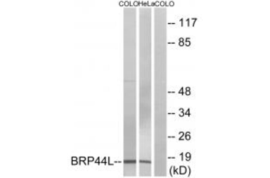 Western blot - BRP44L Antibody from Signalway Antibody (34505) - Antibodies.com