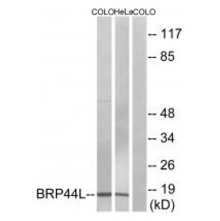 Western blot - BRP44L Antibody from Signalway Antibody (34505) - Antibodies.com