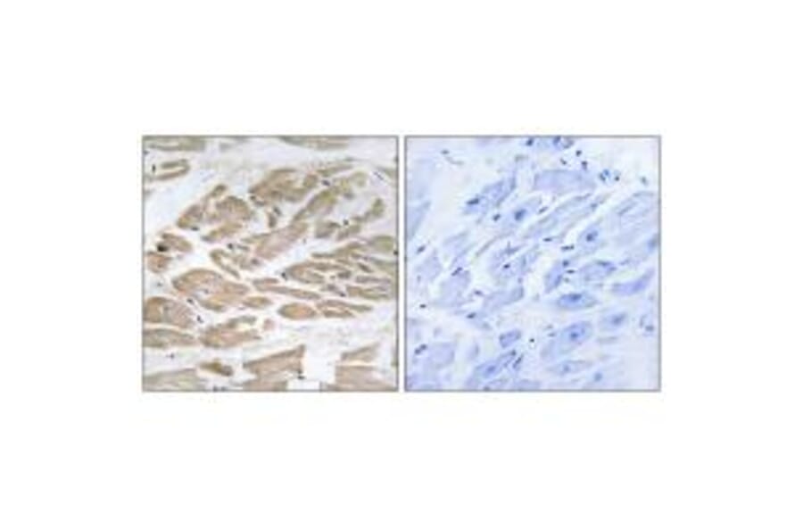Immunohistochemistry - BRP44L Antibody from Signalway Antibody (34505) - Antibodies.com