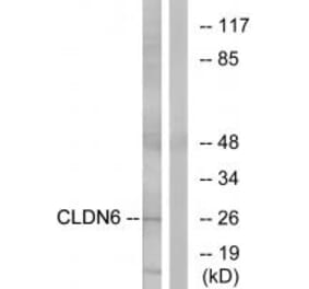 Western blot - CLDN6 Antibody from Signalway Antibody (34597) - Antibodies.com