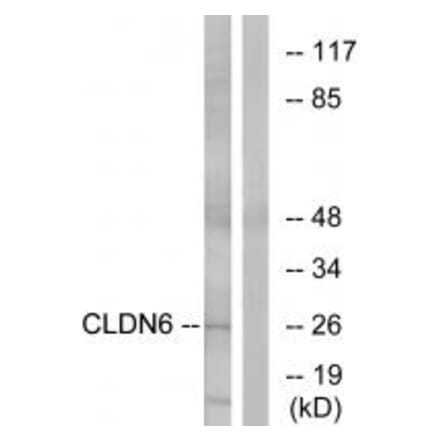 Western blot - CLDN6 Antibody from Signalway Antibody (34597) - Antibodies.com