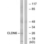 Western blot - CLDN6 Antibody from Signalway Antibody (34597) - Antibodies.com