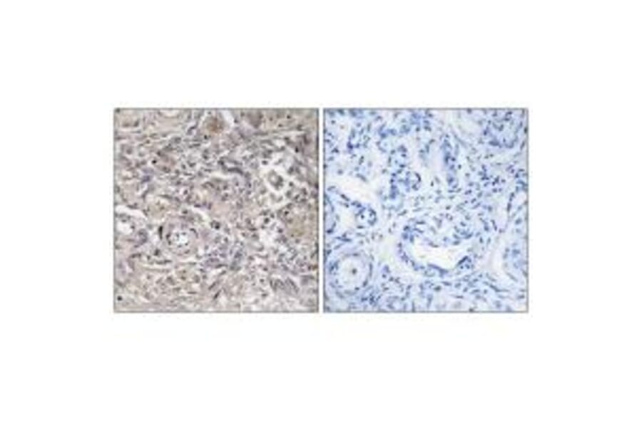 Immunohistochemistry - CLDN6 Antibody from Signalway Antibody (34597) - Antibodies.com