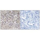 Immunohistochemistry - CLDN6 Antibody from Signalway Antibody (34597) - Antibodies.com