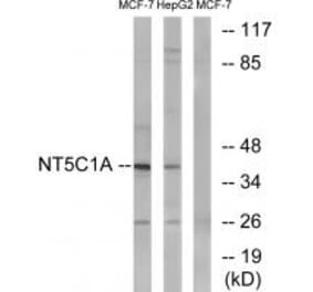 Western blot - NT5C1A Antibody from Signalway Antibody (34634) - Antibodies.com