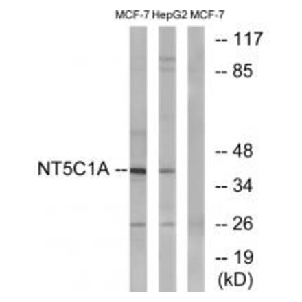 Western blot - NT5C1A Antibody from Signalway Antibody (34634) - Antibodies.com