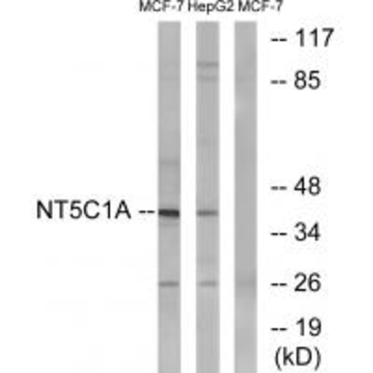 Western blot - NT5C1A Antibody from Signalway Antibody (34634) - Antibodies.com