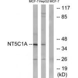 Western blot - NT5C1A Antibody from Signalway Antibody (34634) - Antibodies.com