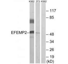 Western blot - EFEMP2 Antibody from Signalway Antibody (34666) - Antibodies.com