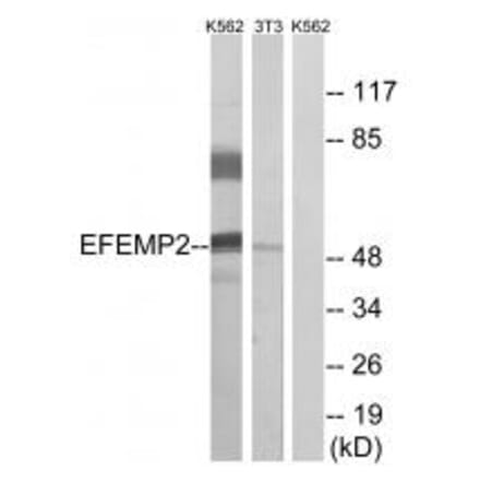Western blot - EFEMP2 Antibody from Signalway Antibody (34666) - Antibodies.com