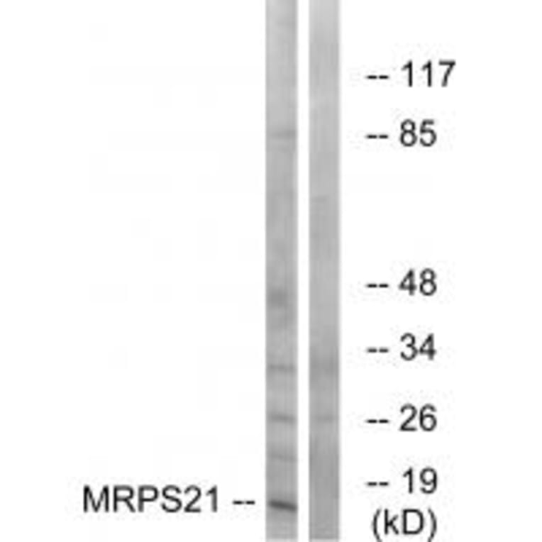 Western blot - MRPS21 Antibody from Signalway Antibody (34790) - Antibodies.com