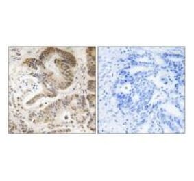 Immunohistochemistry - PIK3R5 Antibody from Signalway Antibody (34903) - Antibodies.com