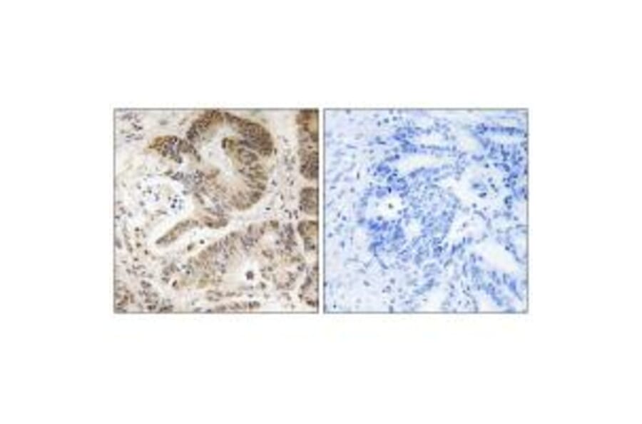 Immunohistochemistry - PIK3R5 Antibody from Signalway Antibody (34903) - Antibodies.com
