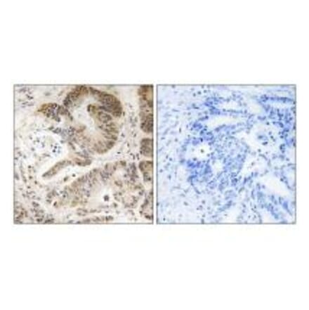 Immunohistochemistry - PIK3R5 Antibody from Signalway Antibody (34903) - Antibodies.com