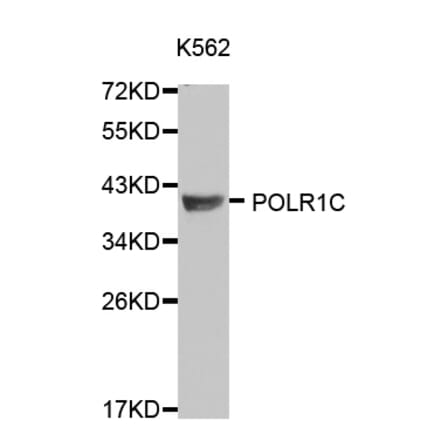 Western blot - POLR1C antibody from Signalway Antibody (38120) - Antibodies.com
