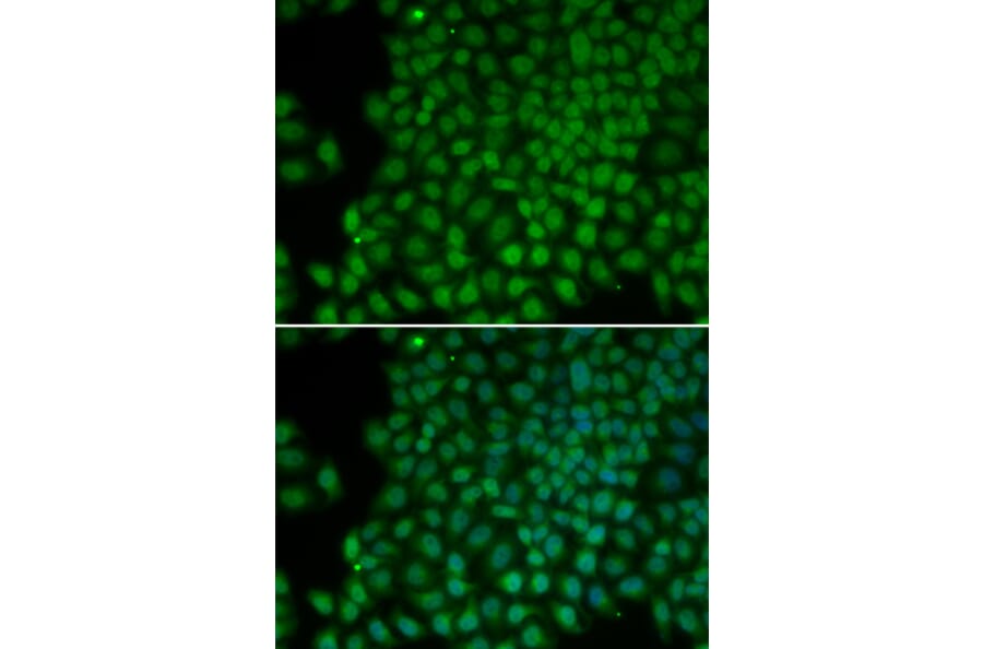 Immunofluorescence - POLR1C antibody from Signalway Antibody (38120) - Antibodies.com