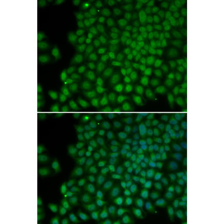 Immunofluorescence - POLR1C antibody from Signalway Antibody (38120) - Antibodies.com
