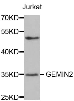 Western blot analysis of extracts of Jurkat cell line, using GEMIN2 antibody.
