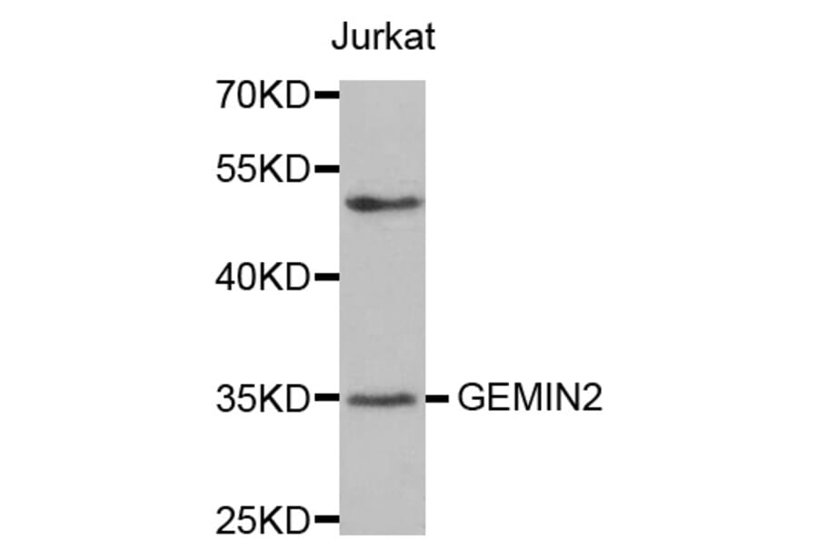 Western blot - GEMIN2 antibody from Signalway Antibody (38570) - Antibodies.com