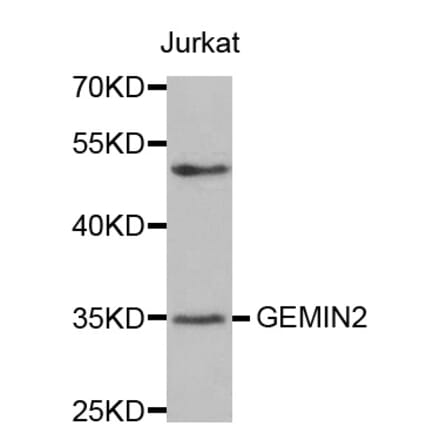 Western blot - GEMIN2 antibody from Signalway Antibody (38570) - Antibodies.com