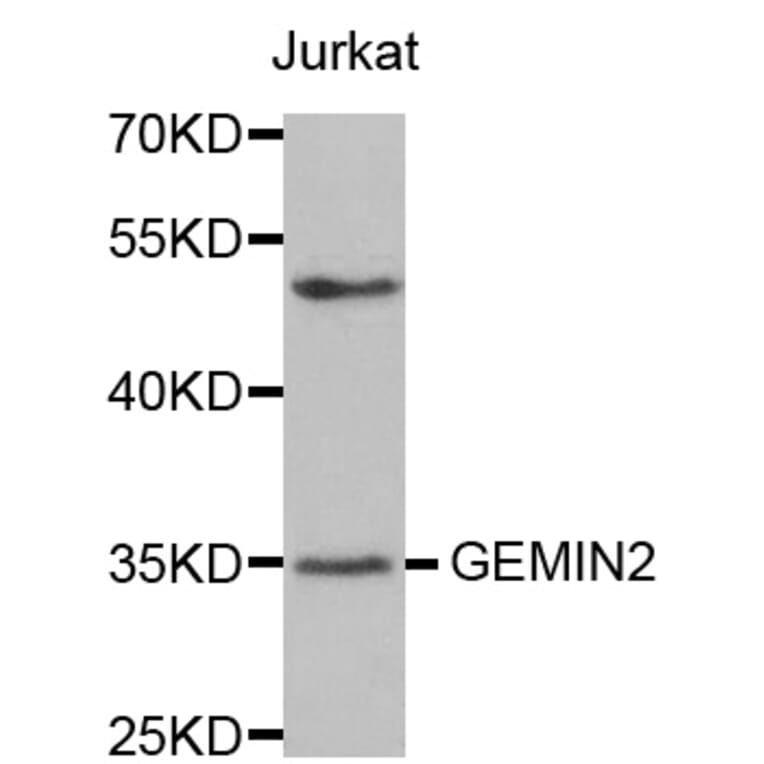 Western blot - GEMIN2 antibody from Signalway Antibody (38570) - Antibodies.com