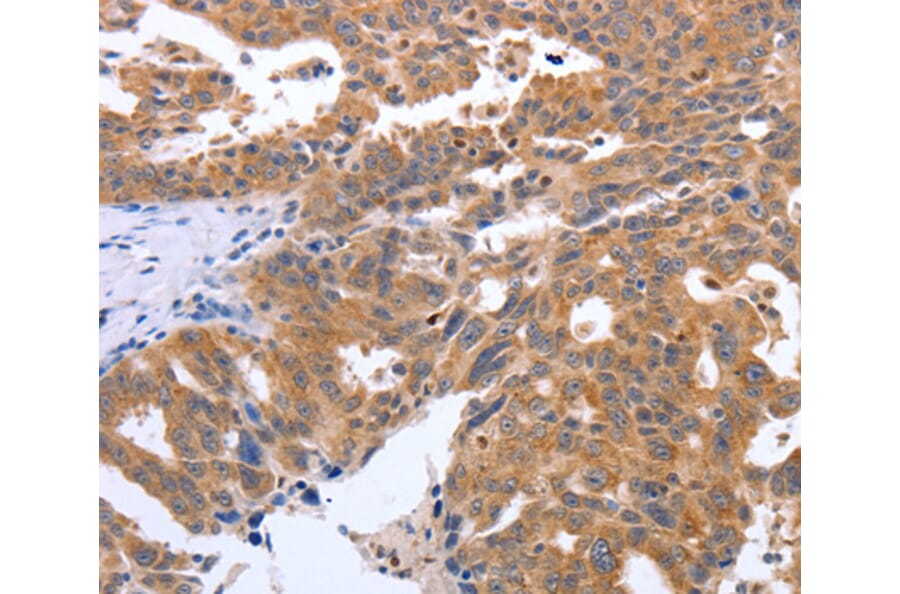 Immunohistochemistry - GEMIN2 antibody from Signalway Antibody (38570) - Antibodies.com