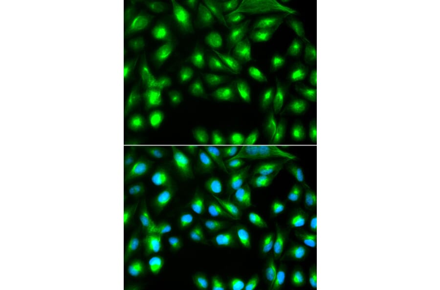 Immunofluorescence - GEMIN2 antibody from Signalway Antibody (38570) - Antibodies.com