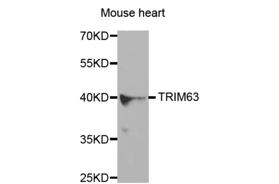 Western blot - TRIM63 antibody from Signalway Antibody (38580) - Antibodies.com